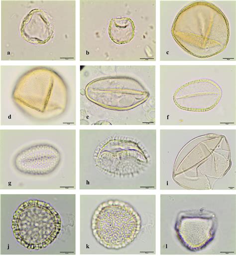 Light Microscopy Photographs Of Pollen Grains Observed In The Royal Download Scientific Diagram