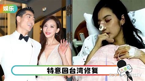 林志玲遭家暴？网民疯传：鼻子被打烂！特意回台湾修复！ 知乎