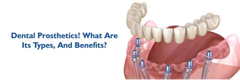 Dental Prosthetics: Types and Benefits for Better Oral Health