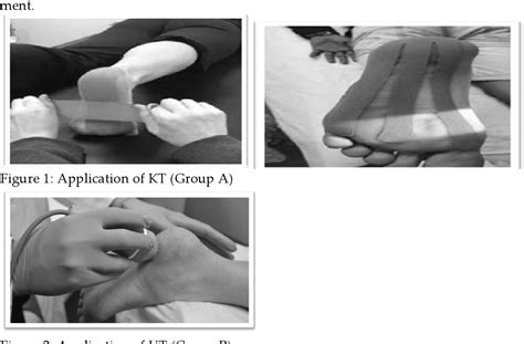 Figure 1 From Comparison Of The Efficacy Of Kinesiology Taping Versus