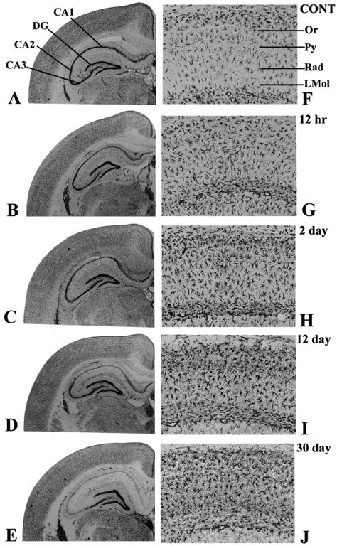 Systemic Administration Of Kainic Acid Induces Selective Time Dependent