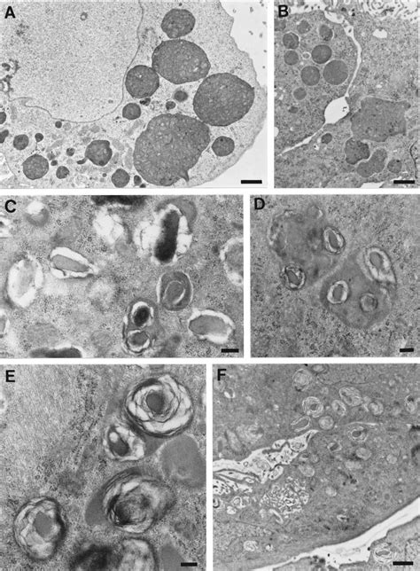 Formation Of Mlbs Via Autophagic Vacuole Degradation After Leupeptin