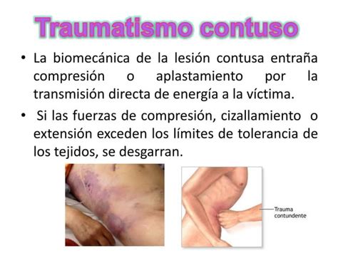 traumatismo abdominal en urgencias médico quirúrgicas PPT