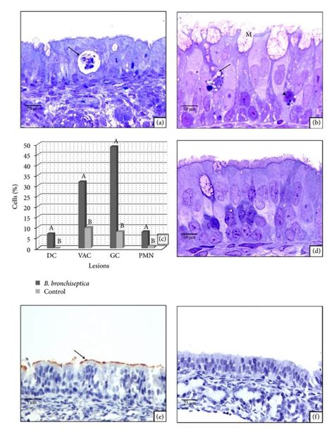 A Tissue Culture Exposed To B Bronchiseptica For 4 Hours Dead