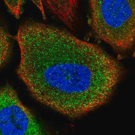 Anti Pygb Antibody Produced In Rabbit