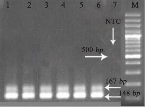 Analysis Of The Multiplex PCR And Sensitivity Of The Reaction In 1 5