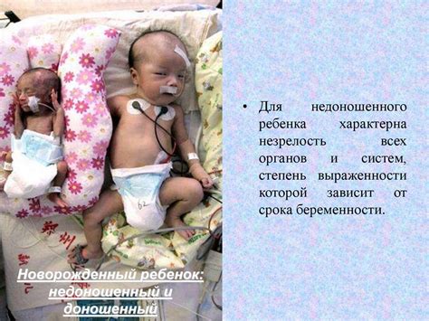 Недоношенный ребенок - online presentation
