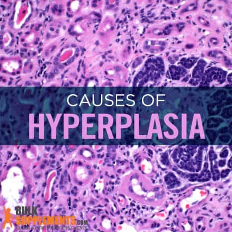 hypertrophy vs hyperplasia Archives