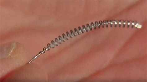 FDA plans to review Essure birth control | FOX 7 Austin