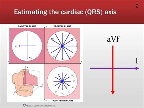 Mean Cardiac Axis Cardiac Vector