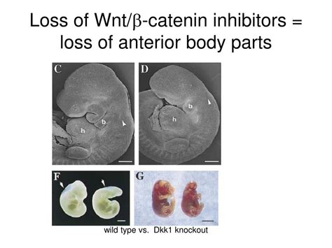 Ppt Wnt Signaling In Development And Disease Powerpoint Presentation