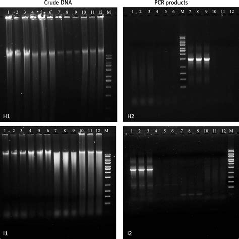 Agarose Gel Electrophoresis Of Crude Dna J And Universal Pcr J