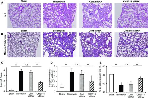 Protective Effect Of Chst Sirna In Bleomycin Induced Pulmonary