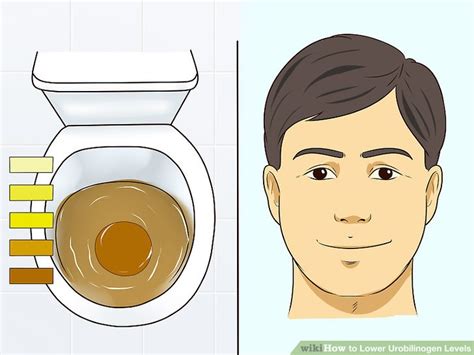 3 Ways To Lower Urobilinogen Levels WikiHow