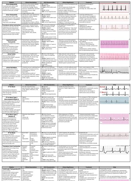 Ecg Interpretation Cheat Sheet Ecg Interpretation Ekg Interpretation 34544 The Best Porn Website