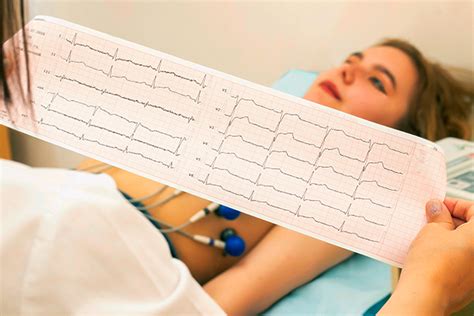 Lectura e Interpretación de un Electrocardiograma Institución Badra