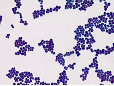 Staphylococcus Epidermidis Endospore Stain