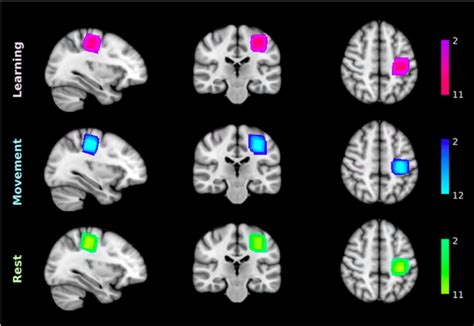 Stagg Group | mrcbndu