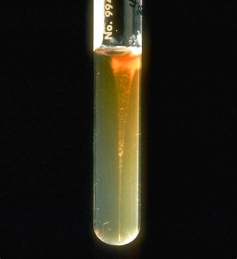 difference  solid media  semi solid media compare