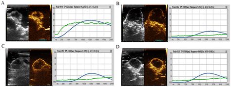 CEUS Image And DCE US Time Intensity Curves Of One Mouse In Group B At