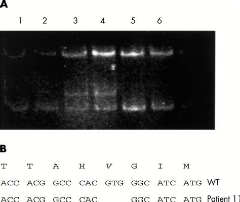 Mutation Screening Of The Pkd1 Transcript By Rt Pcr Journal Of