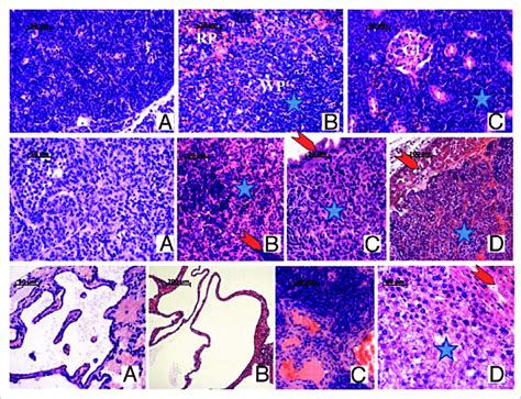 Representative Images Of H E Staining Of Tumors Detected In Mice Of All