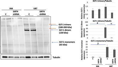 Glt Is Expressed Differently After Sirt Silencing In Iha And U