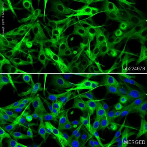 Fitc Anti Beta Iii Tubulin Ep Y Neuronal Marker Ab