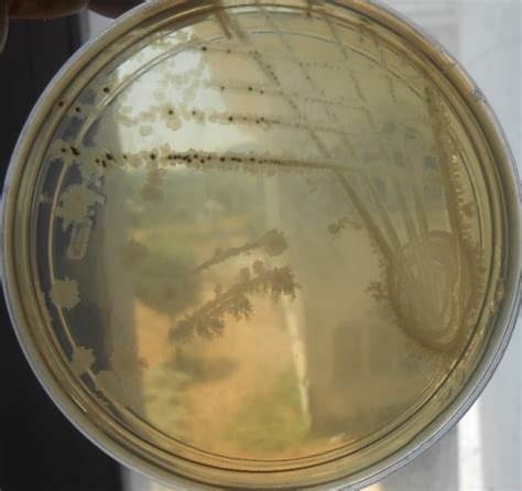 Pure culture of Clostridium perfringens on Sulphite Polymixin ...