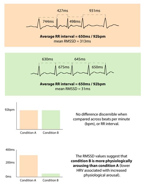 Heart Rate Variability How To Analyze Ecg Data Imotions