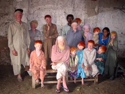 The Bhatti Or White Syrians Albinos From Assyria The Biblical Noah