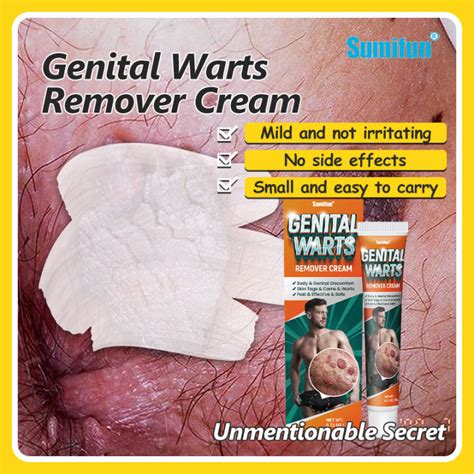 Genital Warts Treatment 20g Original Safe And Gentle Genital Warts Removal Cream For Men Skin