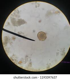 Ascaris Lumbricoides Fertile Egg Light Microscope Nh C S N