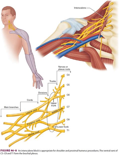 Upper Extremity Peripheral Nerve Blocks Interscalene Block