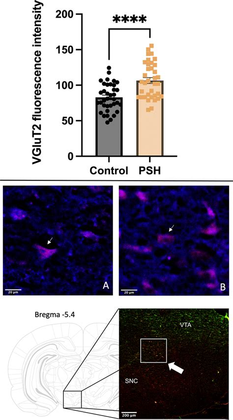 VGluT2 Positive Innervation Of VTA Dopaminergic Neurons Upper Diagram