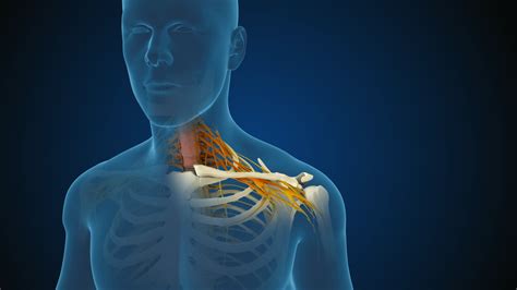 Cervical Radiculopathy Diagram