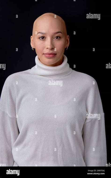 Portrait Of Hairless Woman In White Casual Shirt Looking At Camera