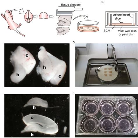 Schematic Diagrams And Photographs Of Procedure For Hippocampal Slice