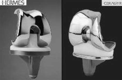 The two designs of knee prosthesis used : Ceragyr mobile-bearing knee ...