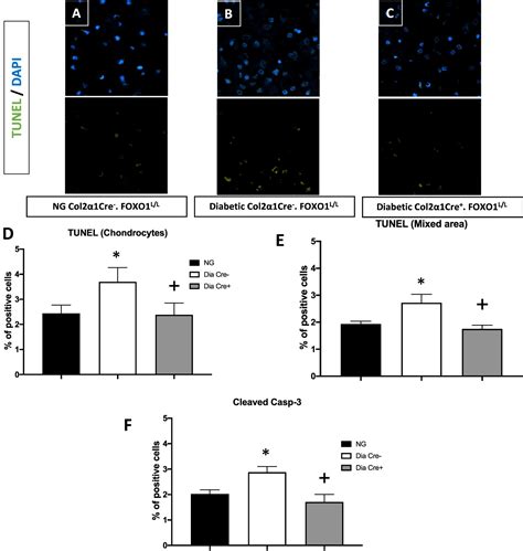 Frontiers Foxo Deletion In Chondrocytes Rescues Diabetes Impaired