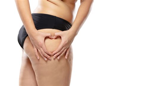 Cellulite Come Combatterla Con La Liposcultura