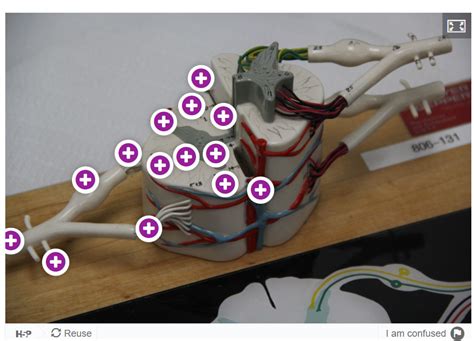 A P Lab Practical 2 Spinal Cord Diagram Quizlet