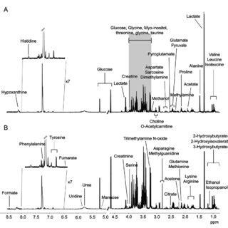 Representative 600 MHz 1 H NMR Spectra Of Serum From A Healthy People