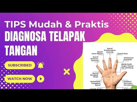 Tips Mudah Dan Praktis Belajar Diagnosa Telapak Tangan Untuk Agen Hni