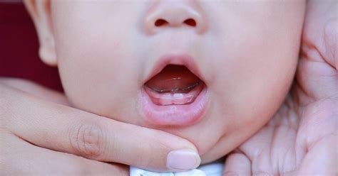 How Long Does Teething Last—what Order They Come In And Alleviating Pain