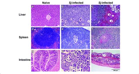 Histopathological Changes And Fibrosis In The Liver Spleen And