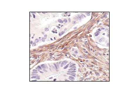 Cancer Associated Fibroblast Marker Antibody Sampler Kit Cell