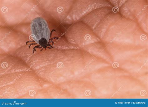 Biting Castor Bean Tick With Hypostom Penetrating A Skin And