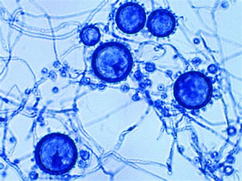 Dimorphic Fungal Pathogens Mycology University Of Adelaide