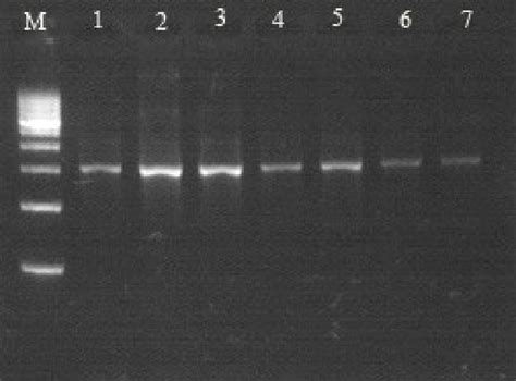 Amplification Of 16s Rdna 1 5 Kb Of Streptomyces Sp Lane M Marker Download Scientific